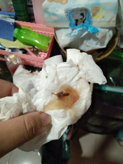 ขอปรึกษาแม่ๆหน่อยค่ะ