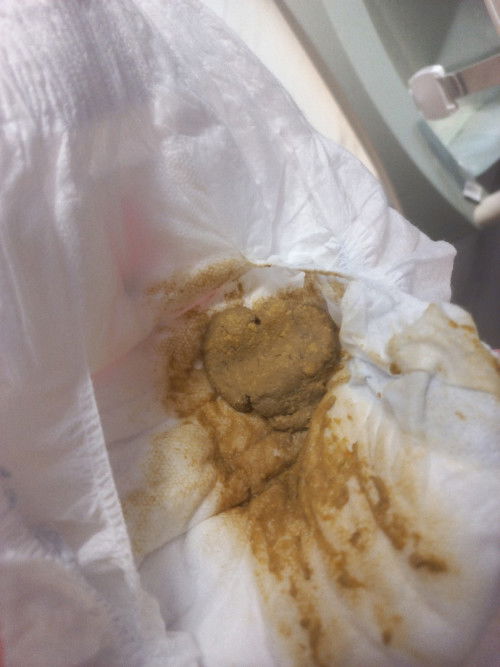 Ganito rin po ba ang poop ng baby niyo 6 months?