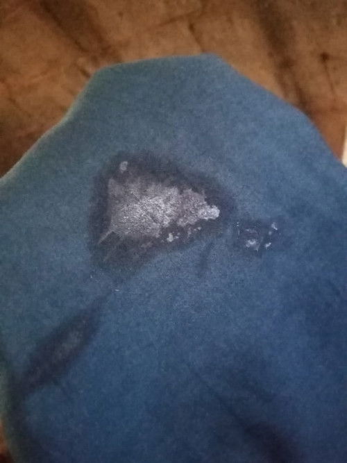 ตกขาวเยอะผิดปกติไหม