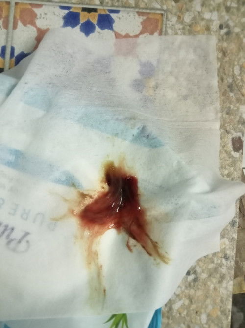 ต้องไปโรงบาลมั้ยค่ะ