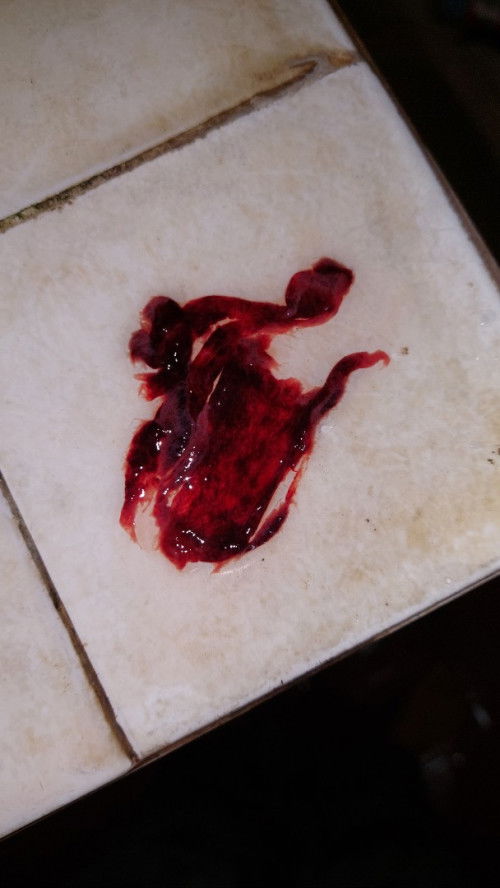 Haid keluar seperti jaringan