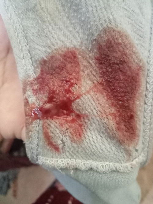 สอบถามหน่อยค่ะแบบนี้ต้องไปหาหมอไหมค่ะ