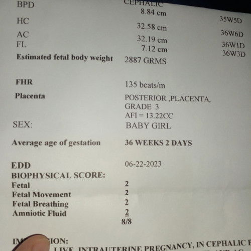 Posterior Placenta Grade 3