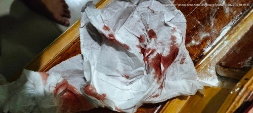 Dan lagi di uk 14week 😭