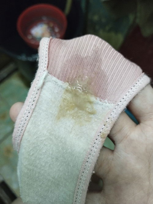 สอบถามแม่ๆ อันนี้มูกหรือตกขาวค่ะ