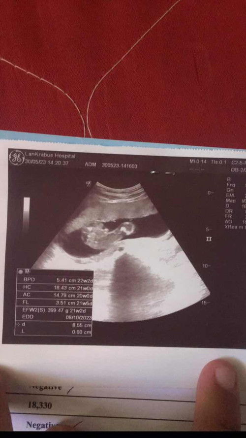 แม่ๆช่วยดูเพศให้หน่อยค่ะ👶🏻