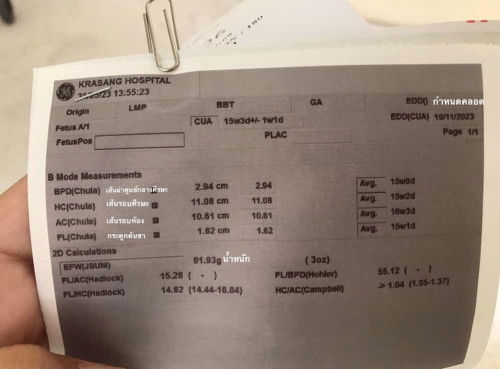 น้องโตตามเกณฑ์ไหมคะ