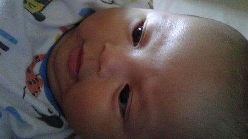 Bercak putih di wajah