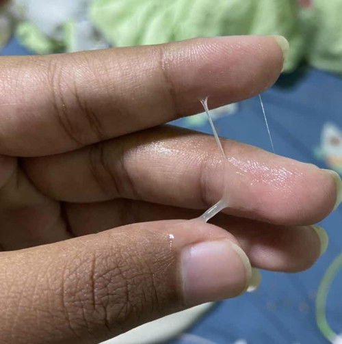 ตอนนี้ท้องได้ 38+2 มีเมือกใสแบบนี้ประมาณ1ช้อนชา มีอาการเจ็บท้องร่วม แบบนี้ใกล้หรือยังค่ะ