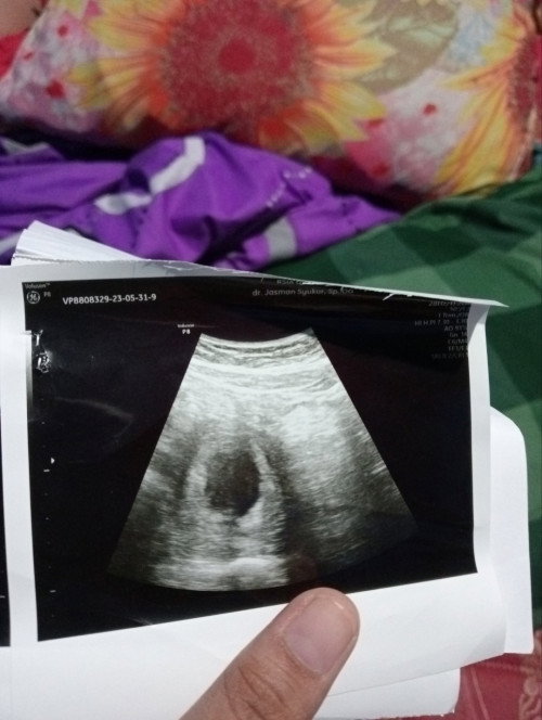 Bun mau nanya ni Bun,barang kali ada yang sama?
