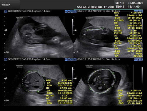 ช่วยดูเพศลูกหน่อยค่ะว่าต้องดูตรงไหน