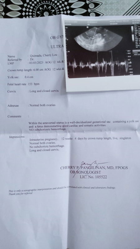 PARANOID @ 12 weeks 🤣🤣