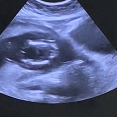 แม่ๆช่วยดูเพศลูกให้หน่อยค่ะ