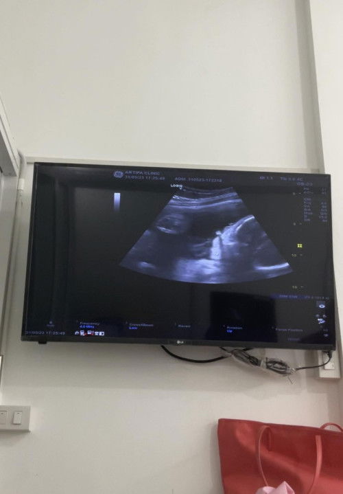 หนุ่มน้อย 31Weeks 1,916 กรัม 🐷