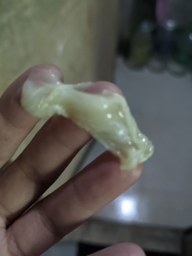 37 weeks, open cervix,manipis, 1cm. May discharge na po ako na ganyan today