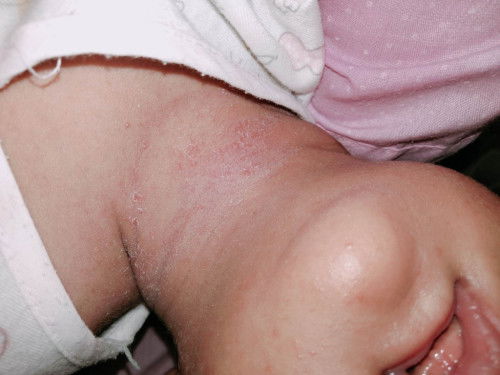 แบบนี้เกิดจากอากาศร้อนรึเปล่าค่ะ