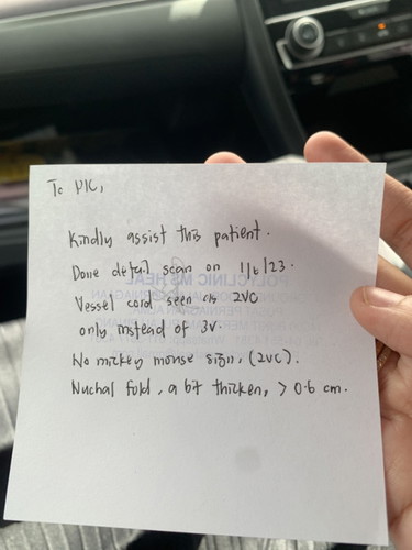 Cuma ada dua tali pusat