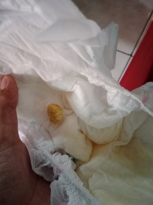 Pup bayi keras. Kaya susah bab apakah normal ya bun.