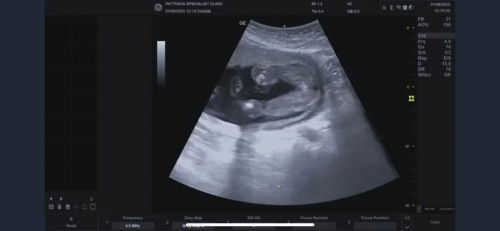 😆😆 อิพ่อบอกเศร้าเลย