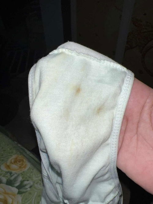 tompok coklat 38 minggu 5 hari