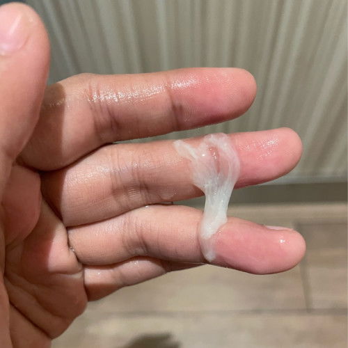 Keluar lendir 33weeks