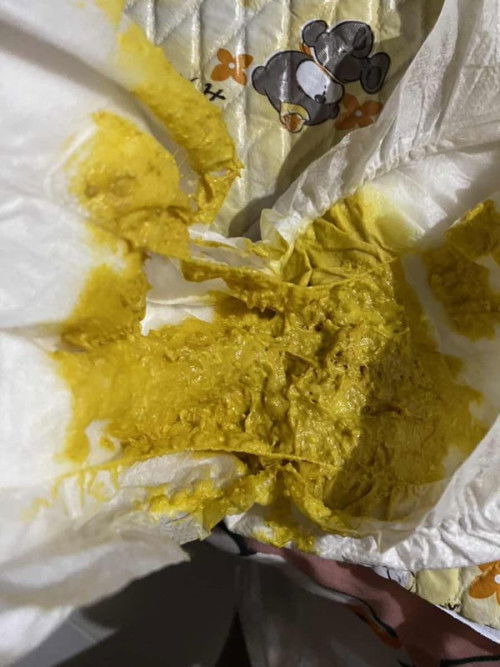 สอบถามหน่อยค่ะ #แม่มือใหม่