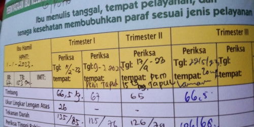 Bb janin kurang atau emg saya yg takut  :")