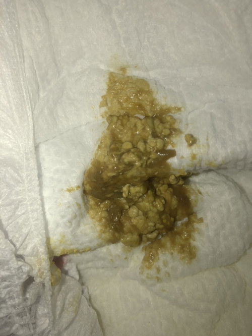 normal ba ang poops ni LO @ 4months old