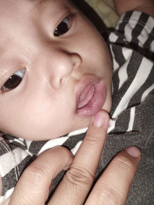 Panas dalam atau penyakit lain?