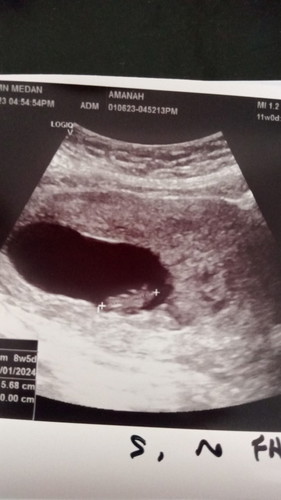 Baby kecik dan tak nampak heartbeat