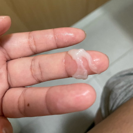แบบนี้ใช่ตกขาวไหมคะ