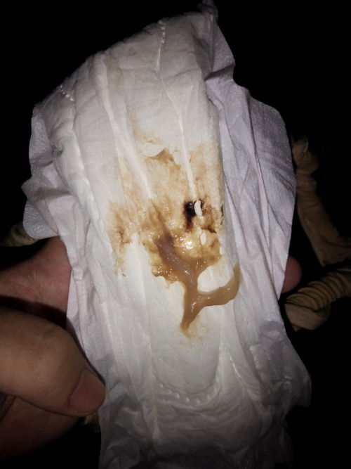 ขอสอบถามเเม่ๆ หน่อยค่ะ