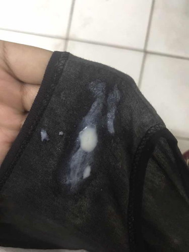 White discharge