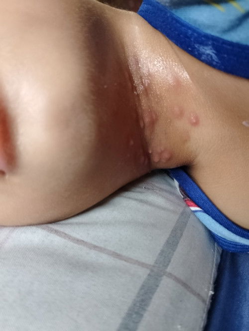 #butlig
anu kaya tong mga butlig na ito, nung natuyo bungang araw nya, yan nman tumubo.