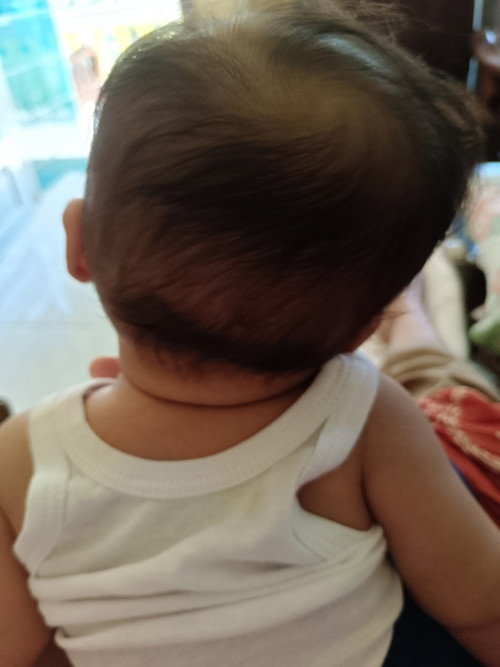 Kepala bayi miring