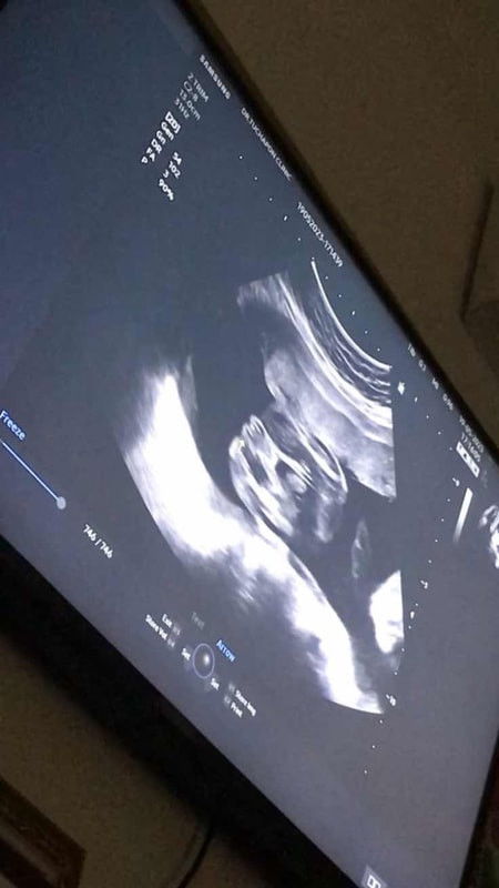 แบบนี้ผู้หญิง100%มั้ยคะ