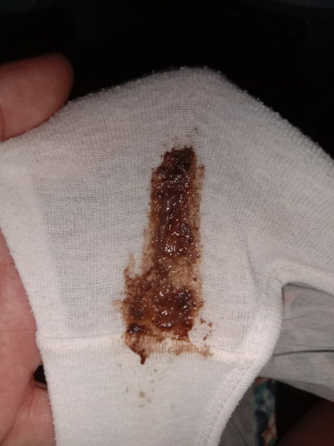 Ask ko lang mga mommies 38weeks sign na ba manganganak na ako?