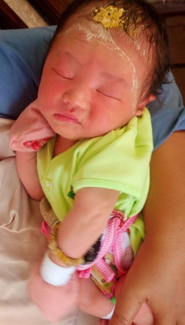 bruntusan pada bayi normal gak sih ? atau  cuman g cocok sama bedaknya/sabun mndinya?