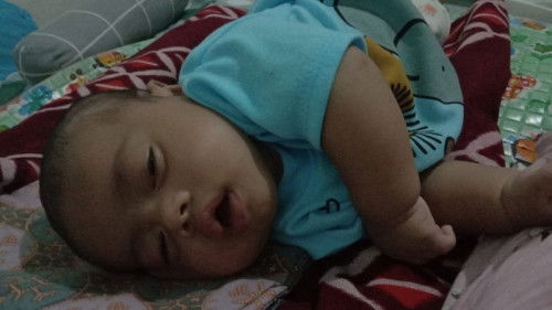 Tidur miring normalkah?