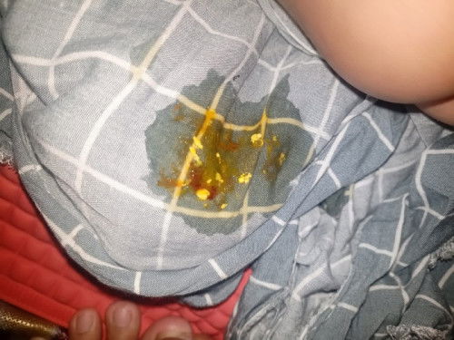 Fases bayi ada lendir merah