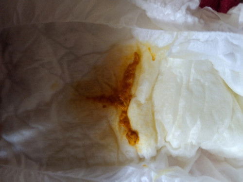 ขอสอบถามค่ะ