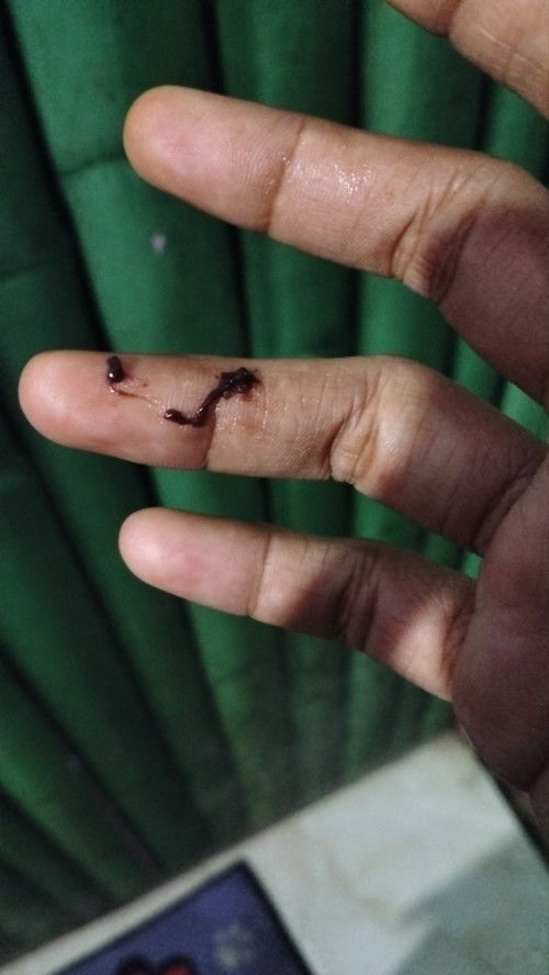 Keluar darah dan gumpalan kecil