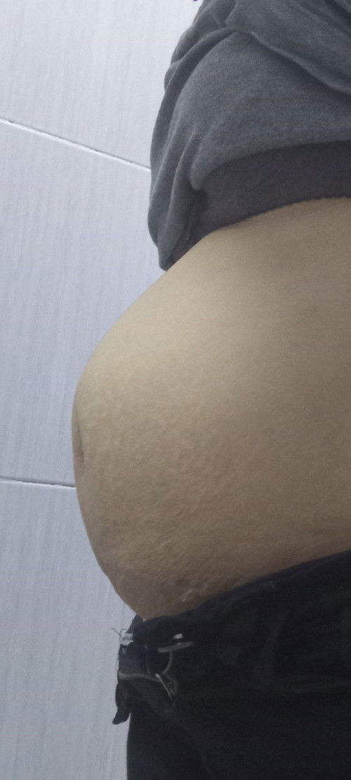 Saya hamil anak ke 5,sudah masuk  15 Minggu tapi koq perut nya terlihat besar sekali