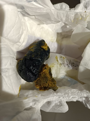 Normal x najis bayi hitam