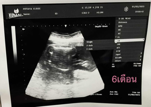 แม่ๆดูออกไหมคะ ว่า ญ หรือ ช