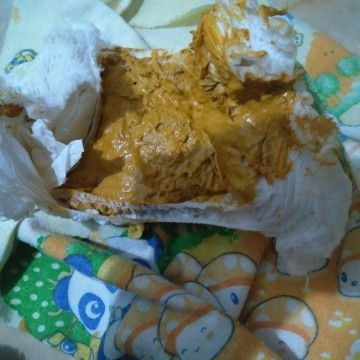 Warna feses bayi 3 bulan