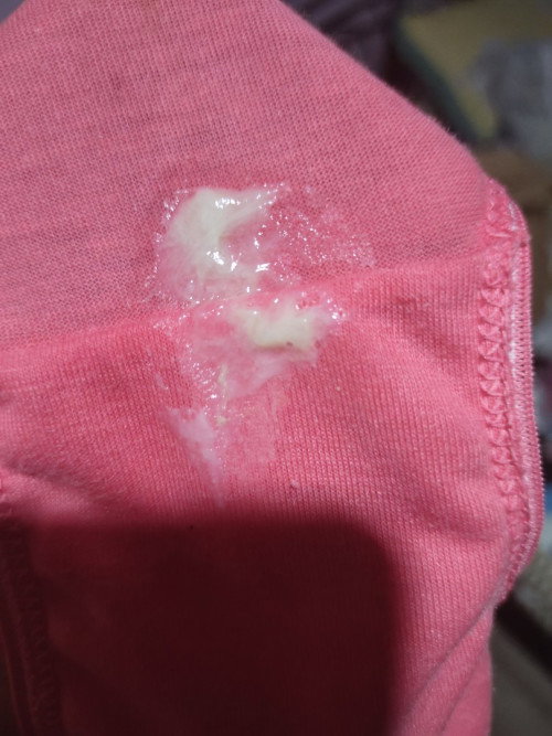 Discharge @ 8weeks