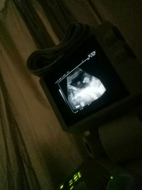 Cuba teka boy or girl