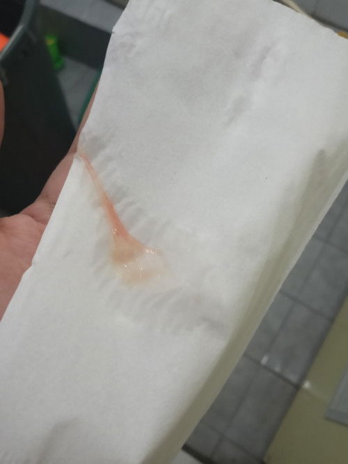 Bun, mau nanya. Hamil 7 minggu, kmrin habis naik motor, keputihan begini. Apakah aman bun?