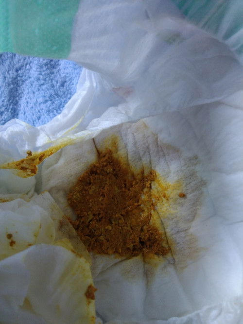 ขอสอบถามแม่ๆค่ะ